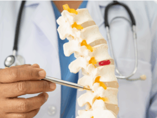 Când este necesară operația de hernie de disc?