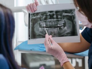 În ce ordine se fac tratamentele dentare complexe