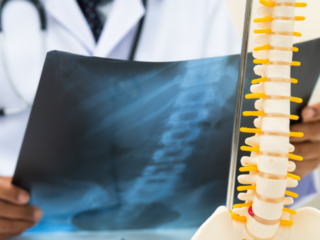 Ai primit diagnosticul de hernie de disc? Ce întrebări ar trebui să pui medicului înainte de tratament
