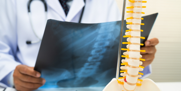 Ai primit diagnosticul de hernie de disc? Ce întrebări ar trebui să pui medicului înainte de tratament